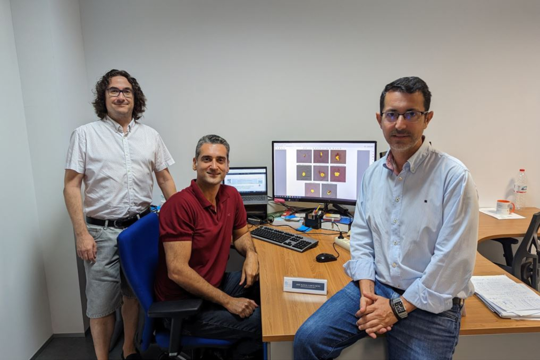 Investigadores del Grupo Khaos participan en la creación de una herramienta basada en Inteligencia Artificial para mejorar la detección precoz del melanoma